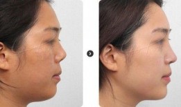 鼻子整形爆料视频大全最新,最新爆料视频大全大揭秘